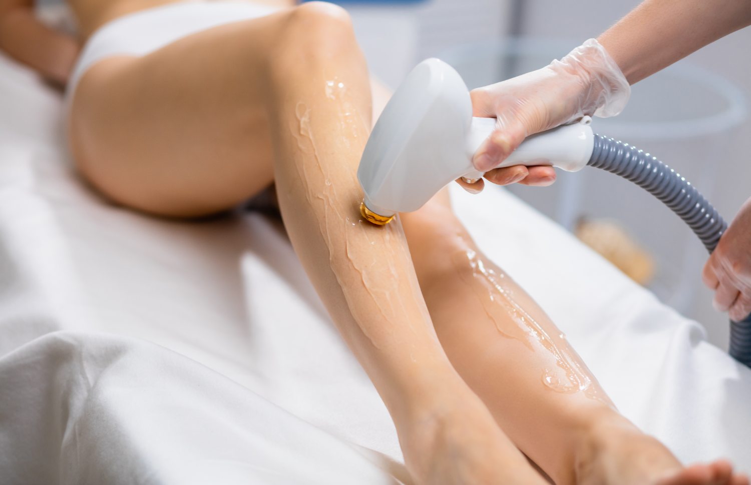 Laser-Haarentfernung an den Beinen mit Diodenlaser